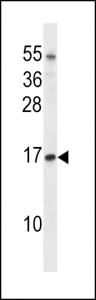 TCEB1 / Elongin C Antibody (aa69-98)