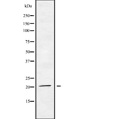MED29 / IXL Antibody