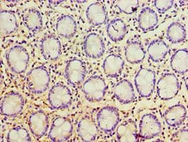 PSCA Antibody (aa12-114)