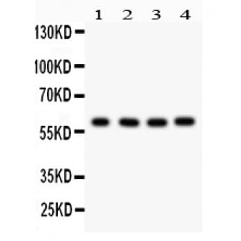 CDC73 / Parafibromin Antibody (aa119-520)