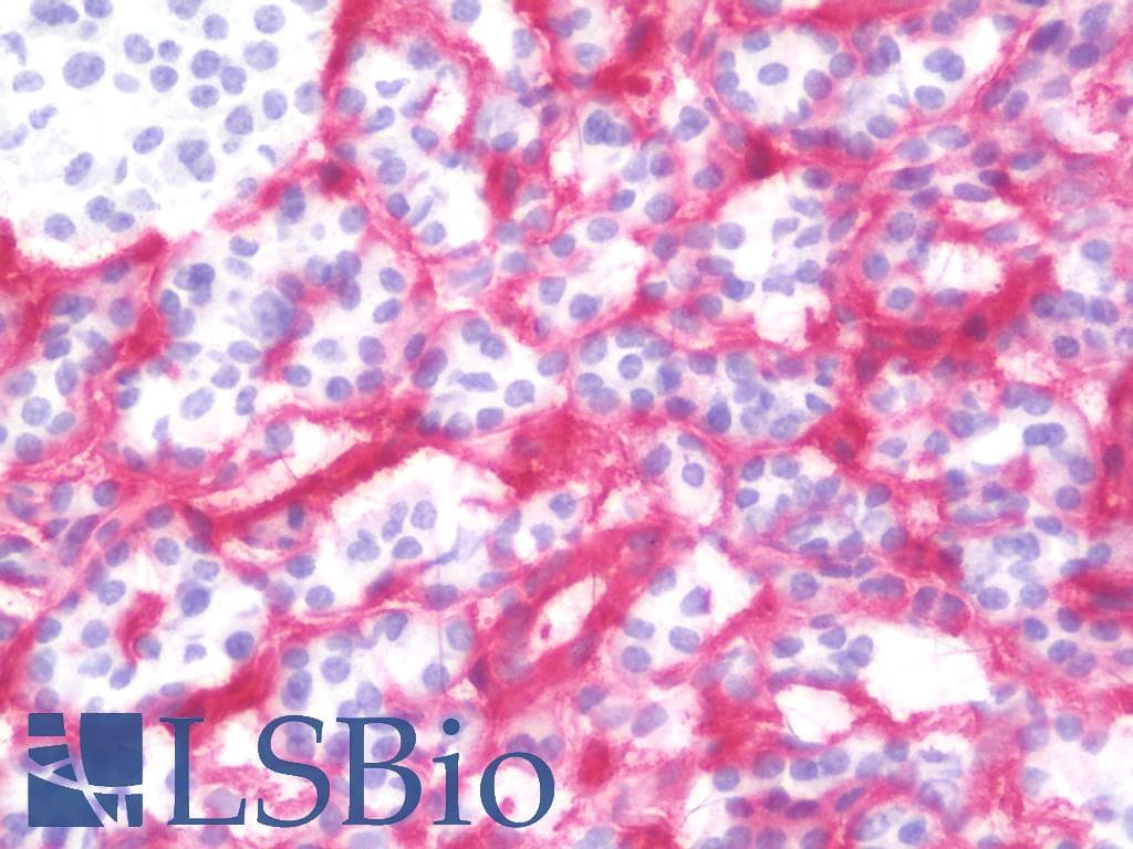 IHC-plus™ HSPG2 / Perlecan Antibody (clone A7L6)