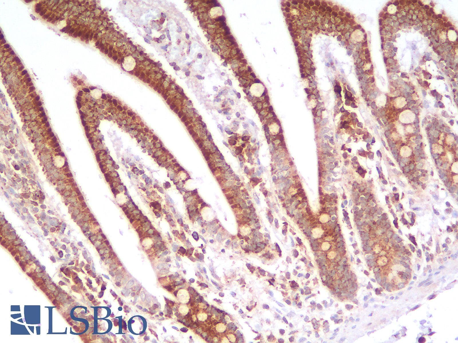 IHC-plus™ HSPD1 / HSP60 Antibody (clone rGROEL/780)