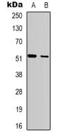 SH2D2A Antibody (Internal)