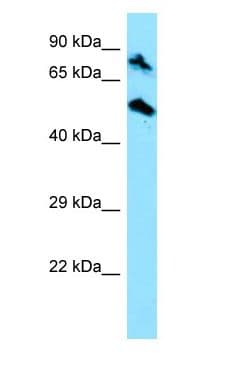 TOP1MT Antibody (aa522-571)