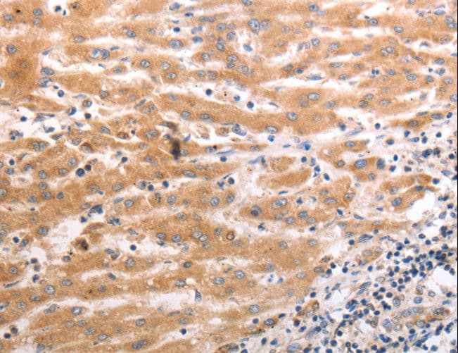 Polyclonal Rabbit anti-Human OX1R / Orexin Receptor 1 Antibody (IHC)