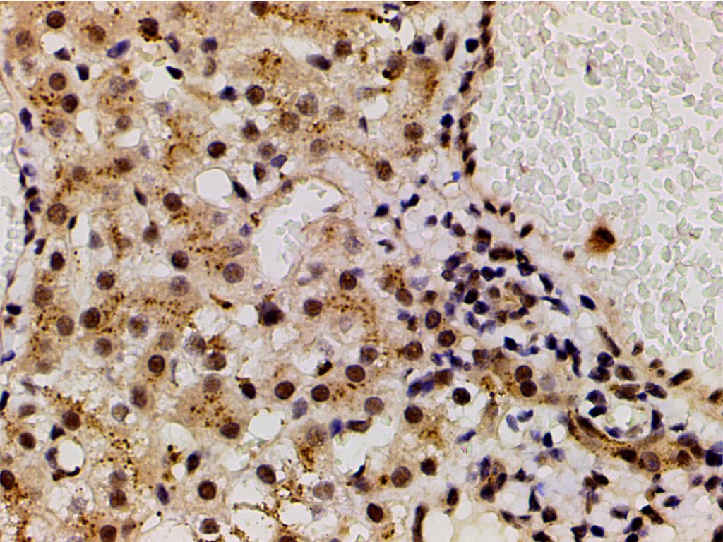 LIMK1 / LIMK Antibody (phospho-Thr508)