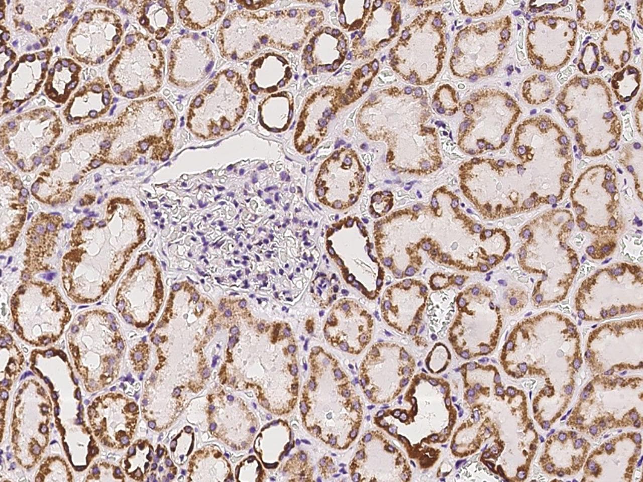 QCR2 / UQCRC2 Antibody