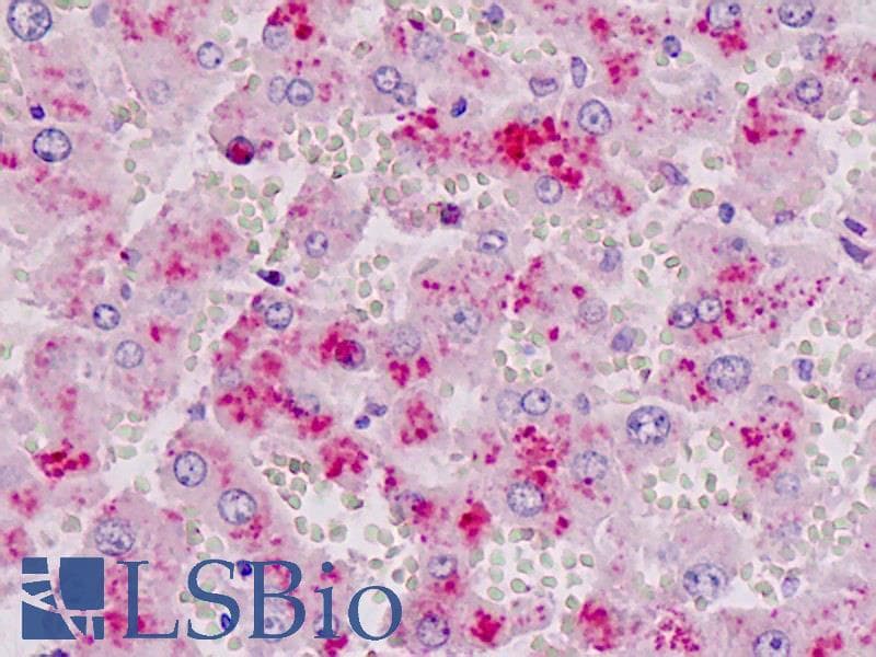 IHC-plus™ HK1 / Hexokinase 1 Antibody (clone 3A10)