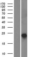 RTN1 / Reticulon 1 Protein (Over-Expression Lysate Myc-DDK (Flag))