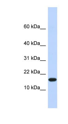 EGLN2 / PHD1 Antibody (aa281-315)