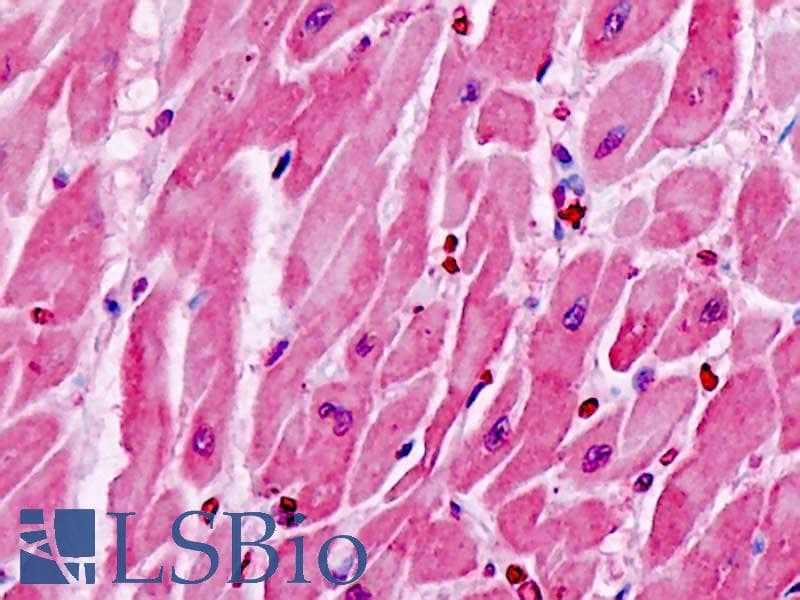 IHC-plus™ CYSLTR1 / CYSLT1 Antibody (aa131-180)