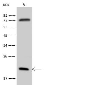 RPL18A Antibody