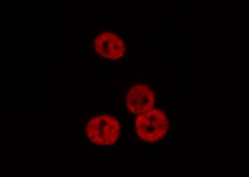 RARA / RAR Alpha Antibody