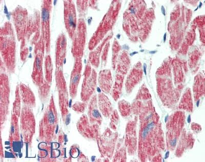 IHC-plus™ UQCRFS1 Antibody (aa181-209)