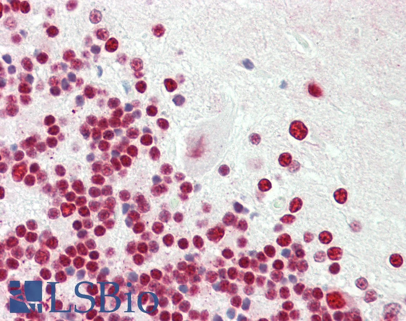 IHC-plus™ SRSF3 / SRP20 Antibody (aa120-170)