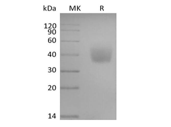 Human SLAMF6 / NTBA Protein (Recombinant AVI-6His, C-terminus)