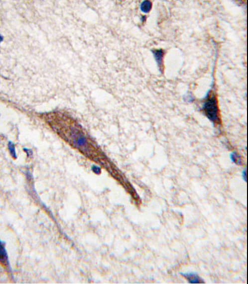 Polyclonal Rabbit anti-Human PAK7/PAK5 Antibody (aa168-198, IHC, WB)