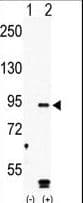 MARK4 Antibody (aa611-641)