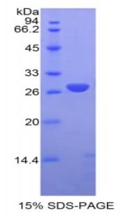 Human GSTM1 Protein (Recombinant His)