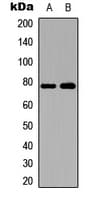 Polyclonal Rabbit anti-Human SKIL / SNO / SnoN Antibody (C-Terminus, IHC, WB)