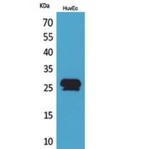 Polyclonal Rabbit anti-Human CACYBP Antibody (161-210 aa, C-terminal, IHC, WB)