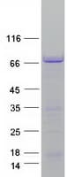 Human MAP2 Protein (Recombinant Myc-DDK (Flag))
