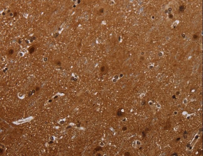 MAGEB18 Antibody