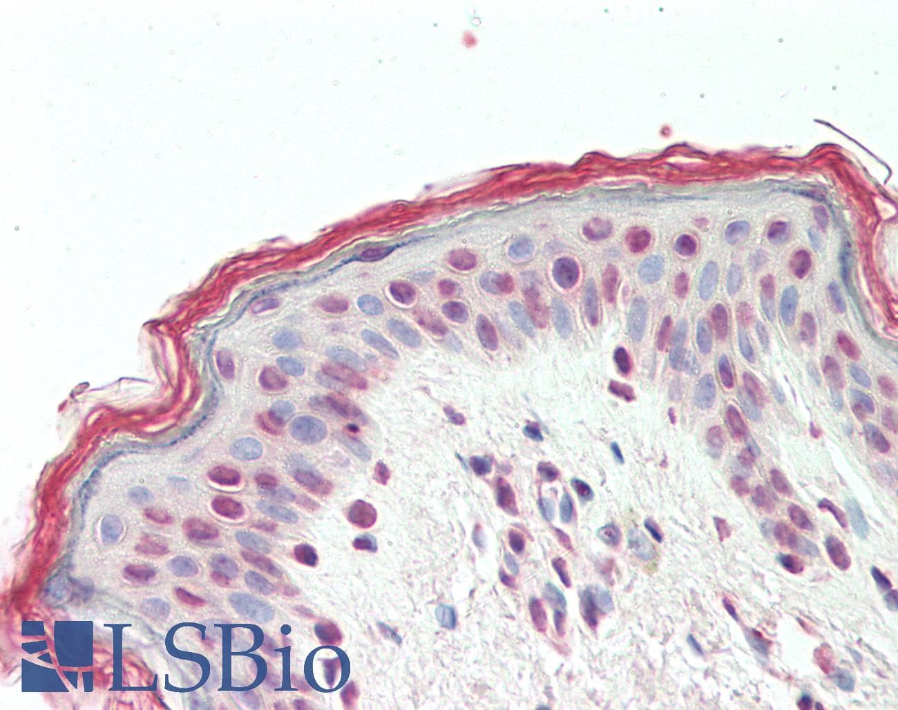 IHC-plus™ TGIF2 Antibody (aa211-220)
