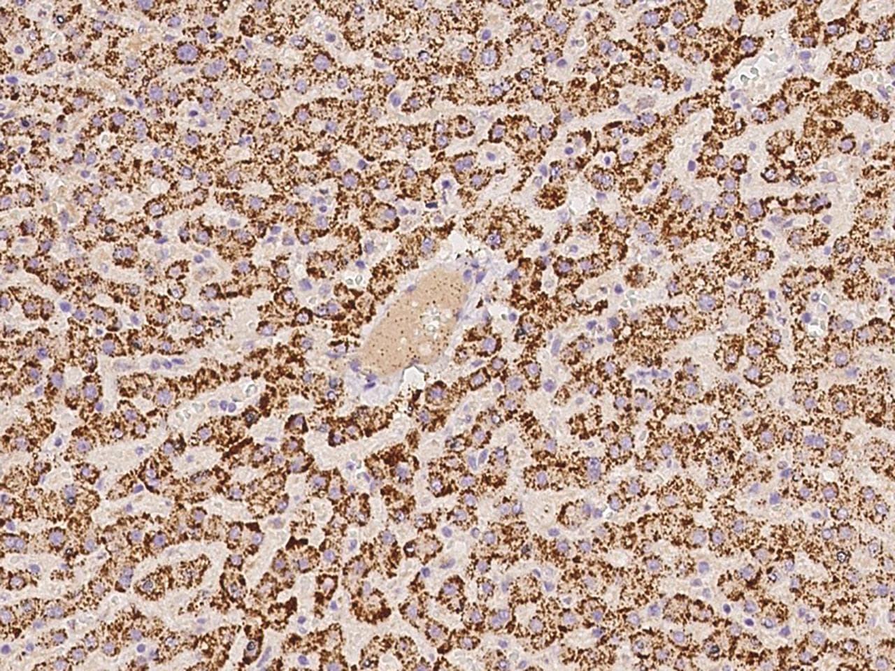 Polyclonal Rabbit anti-Human ACOX1 / ACOX Antibody (IHC, IF)