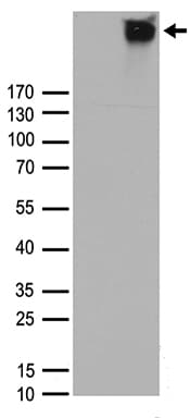 CASR/Calcium Sensing Receptor Antibody