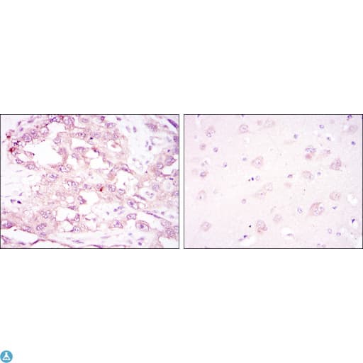 PRKAA1 / AMPK Alpha 1 Antibody