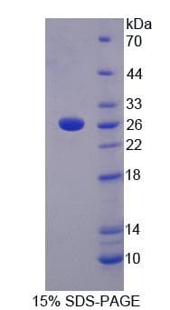 Human LRP3 Protein (Recombinant His-T7)