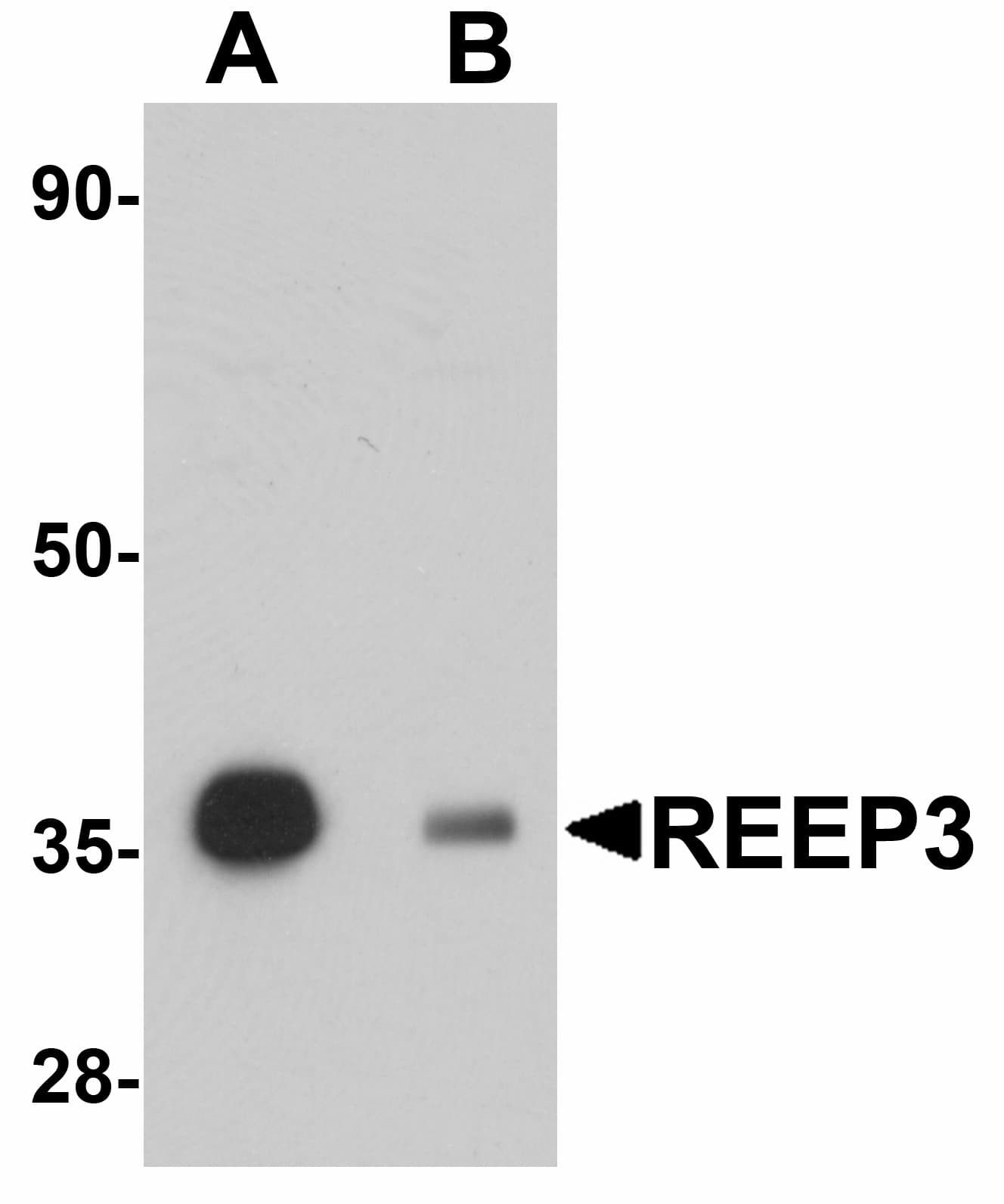IHC-plus™ Polyclonal Rabbit anti-Human REEP3 Antibody (IHC, IF, WB)