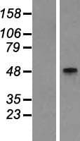 GCNT2 Protein (Over-Expression Lysate Myc-DDK (Flag))
