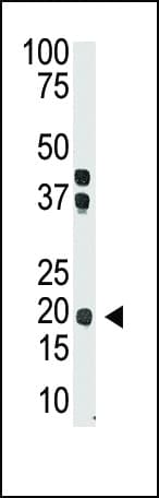 Polyclonal Rabbit anti-Human IFNL2 / IL28A Antibody (aa61-92, WB)
