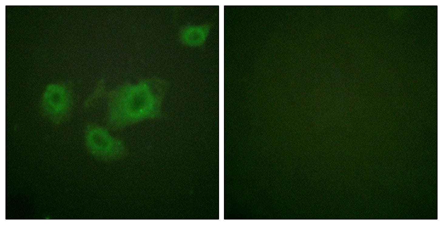 KCNJ11 / Kir6.2 Antibody (phospho-Thr224)