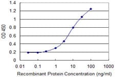 CYLD Antibody (clone 2C3)