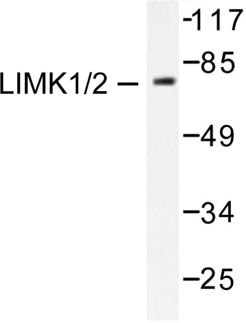 LIMK1 + LIMK2 Antibody (Asp402)