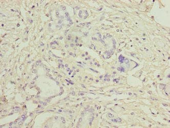 LRG1 / LRG Antibody