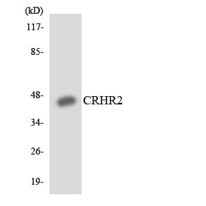 Polyclonal Rabbit anti-Human CRHR2 / CRF2 Receptor Antibody (aa64-113, WB)