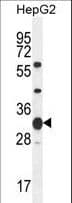 SOHLH1 Antibody (aa40-68)