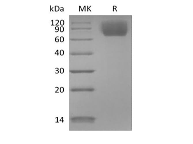Mouse NTRK3 / TRKC Protein (Recombinant 6His, C-terminus)
