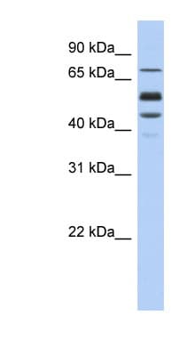 PROS1 / Protein S Antibody (aa251-300)