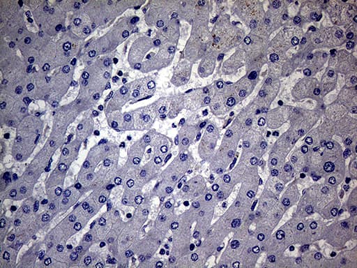 MAK Antibody (aa291-623, clone OTI1G2)