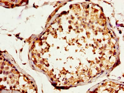 TNNI3 / Cardiac Troponin I Antibody