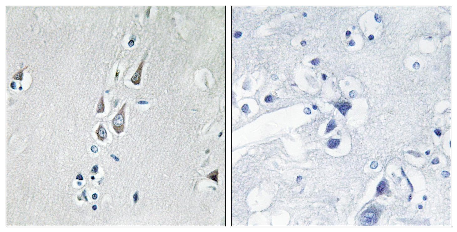 CAMK2 / CAMKII Antibody (phospho-Thr286)