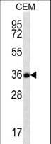 FSTL3 / FLRG Antibody (aa229-258)