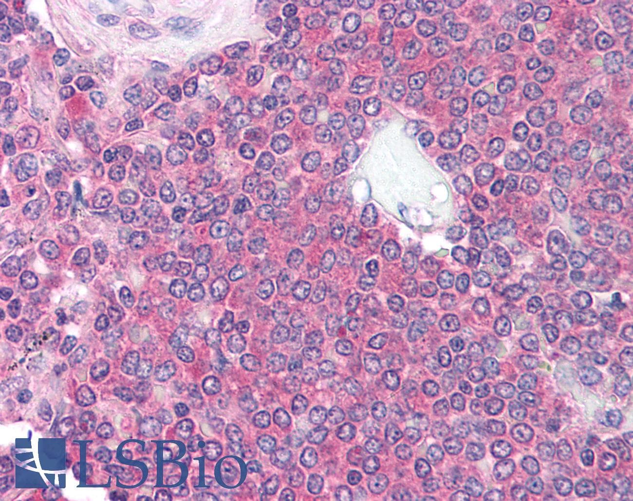 IHC-plus™ CD101 Antibody (clone 2A1H5E1)