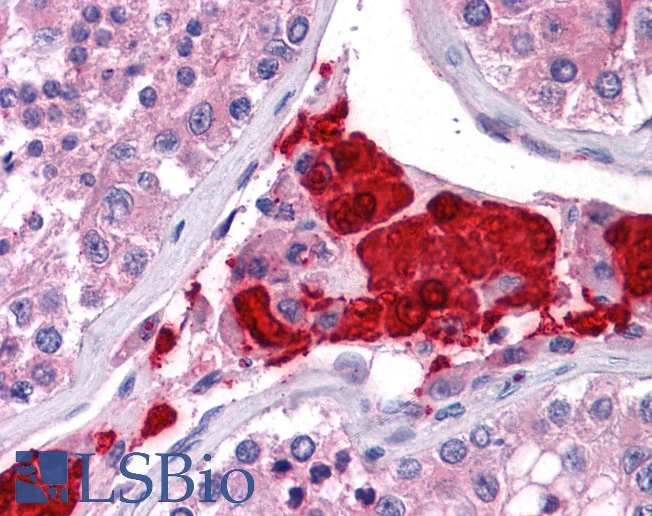 IHC-plus™ TTC1 Antibody (clone 4E3)