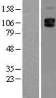 SELP / P-Selectin / CD62P Protein (Over-Expression Lysate Myc-DDK (Flag))